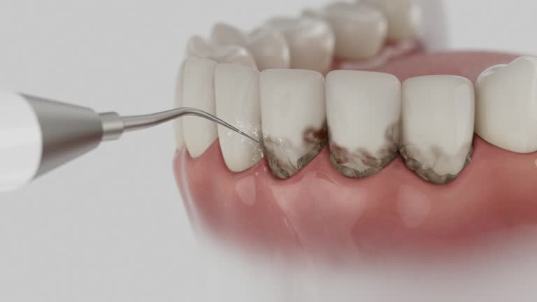 Reliable Tooth Extraction contractor in Roberts County County, TX by Dentist Open Now